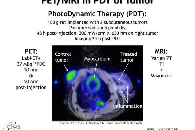 PET/MRI in PhotoDynamic Therapy (PDT) of Tumor