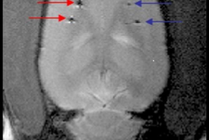 Image transversale d'un cerveau