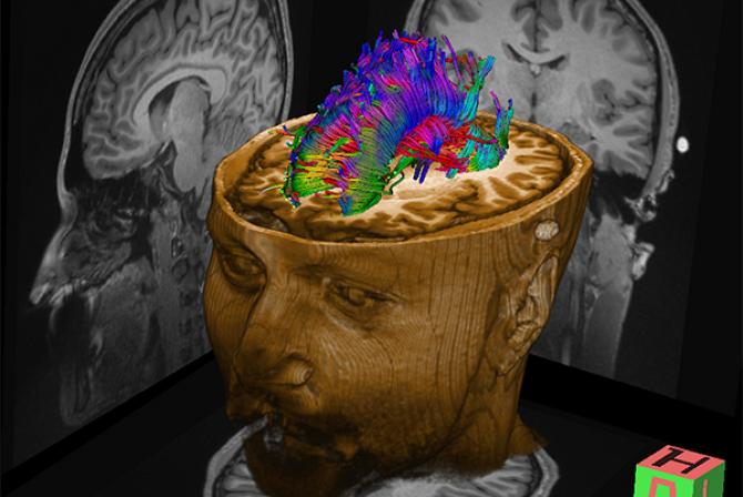Image tridimensionnelle du cerveau human
