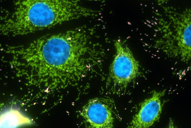 Image of breast cancer cells produced by an epifluorescence microscope.