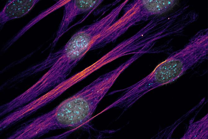 Image of human fibroblasts produced by a Nikon C2 Confocal Microscope.