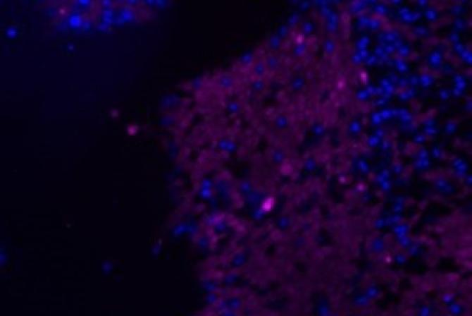 Image of human stem cells produced by the research infrastructure