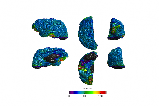 Imagerie en couleur de sections du cerveau